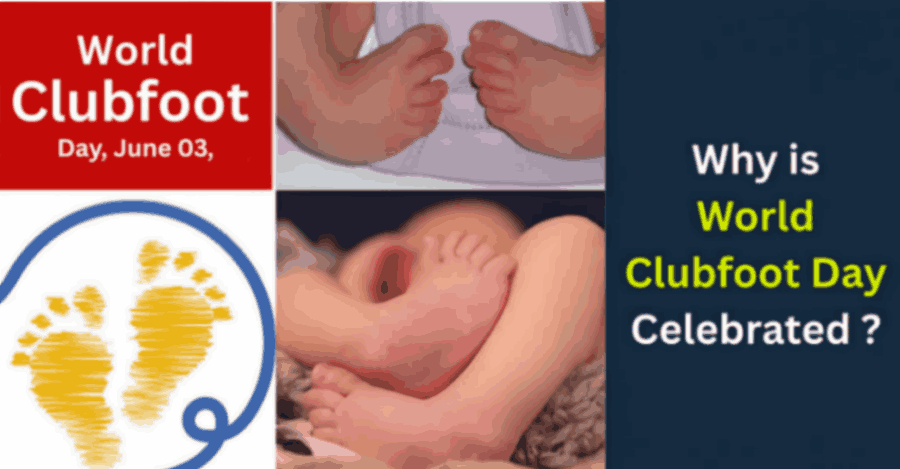 World Clubfoot Day