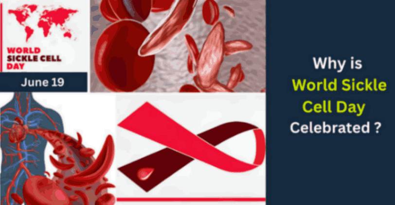 World Sickle Cell Day